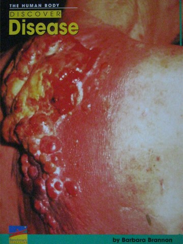 (image for) English Explorers Discover Disease (P) by Barbara Brannon