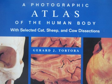 (image for) A Photographic Atlas of the Human Body (Spiral) by Tortora